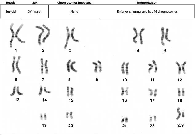 Chromosomes