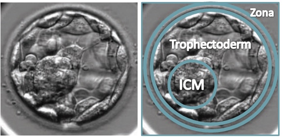 Blastocyst